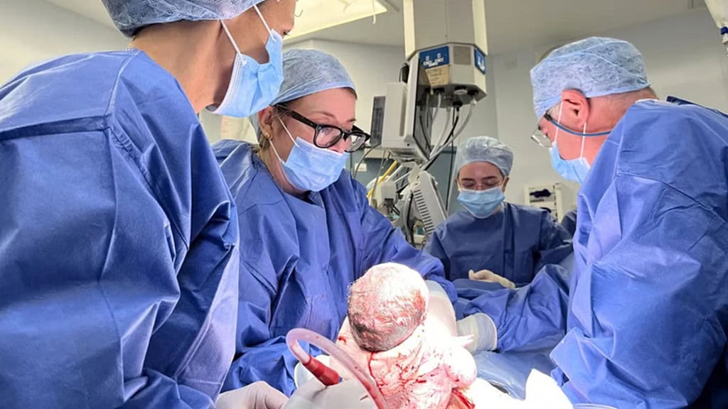 Mulher que nasceu sem útero dá à luz após transplante de doadora falecida